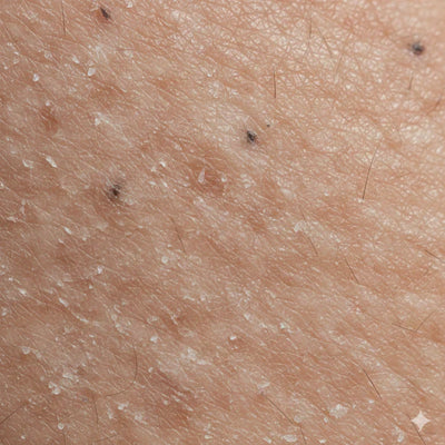 Tackles dull, rough skin